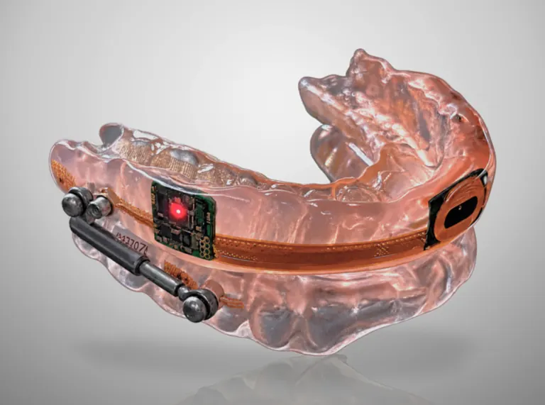 The iNOS biosensor and its flex circuit inside the custom oral appliance